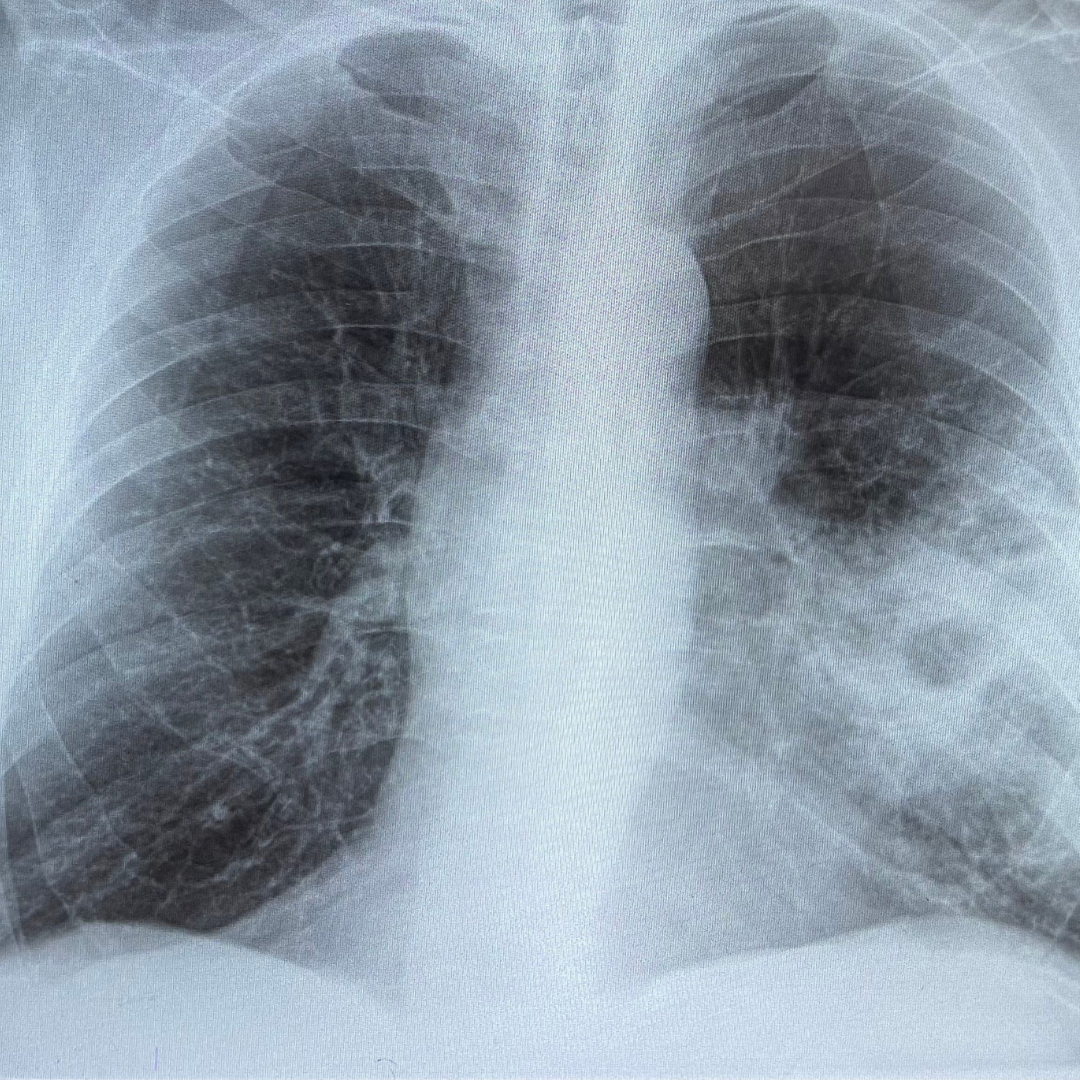 Izdelek brez naslova